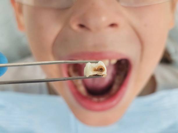 Best Pediatric Emergency Dentist in Terre Haute, IN